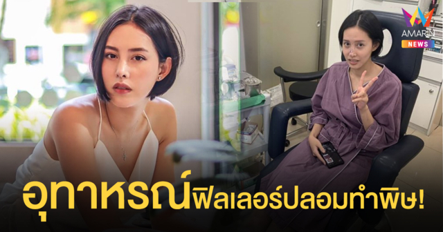 อุทาหรณ์ฟิลเลอร์ปลอมทำพิษ! 