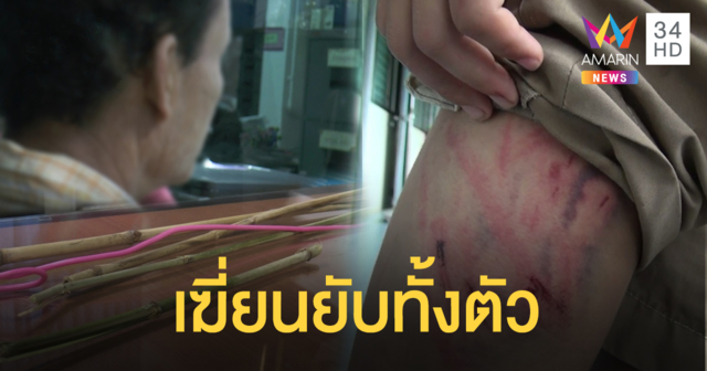 พ่อเฆี่ยน 10 ขวบยับทั้งตัว อ้างโมโหลูกเอานมโรงเรียนแจกฟรีไปขาย ซื้อประทัดเล่น