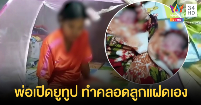 พ่อเปิดยูทูปทำคลอดลูกแฝดเอง หลังเมียคลอดกะทันหันกลางดึก