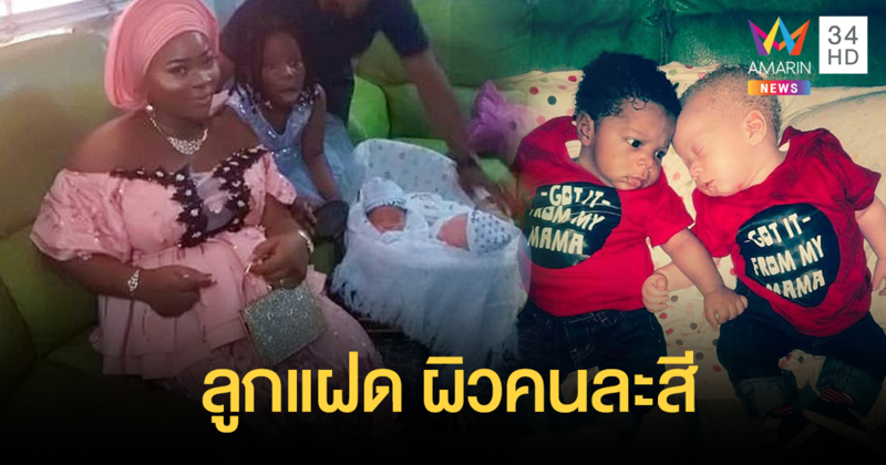 ตะลึง แม่ชาวไนจีเรียคลอดลูกแฝด "ผิวคนละสี"