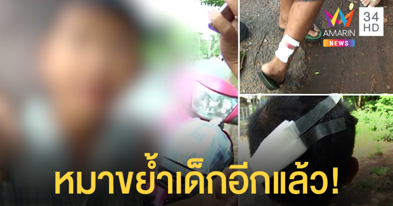 อีกแล้ว! สุนัขจรจัดขย้ำเด็ก 9 ขวบ
