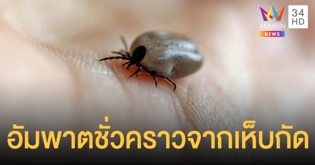 กรมการแพทย์ แนะหยุดอาการอัมพาตชั่วคราวจากเห็บกัด