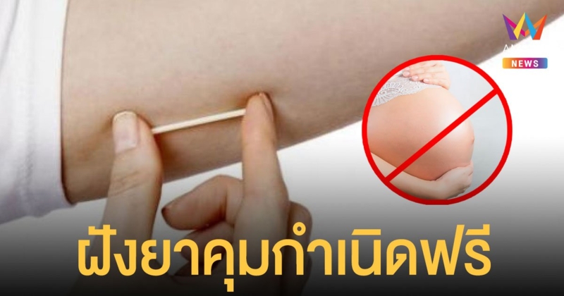 เช็กเลย!  บริการ ฝังยาคุมกำเนิดฟรี สำหรับวัยรุ่นอายุต่ำกว่า 20 ปี
