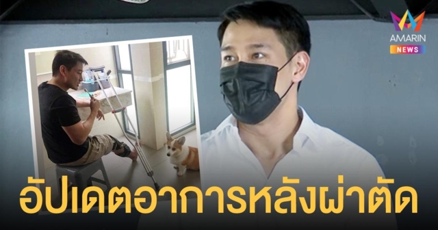 ป้อง ณวัฒน์  อัปเดตอาการ หลังผ่าตัดเอ็นไขว้หน้าเข่าขวา  ตอนนี้ทำกายภาพ - ฟื้นฟูกล้ามเนื้อ