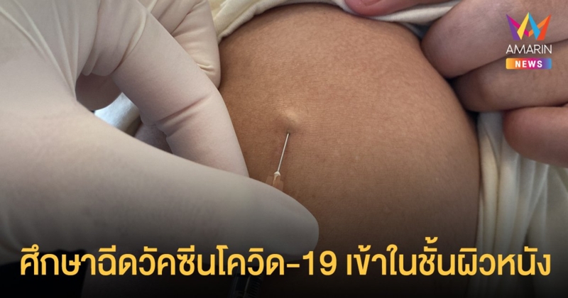 ศึกษาฉีดวัคซีนโควิด-19 เข้าในชั้นผิวหนังประหยัดวัคซีนได้เกินครึ่ง