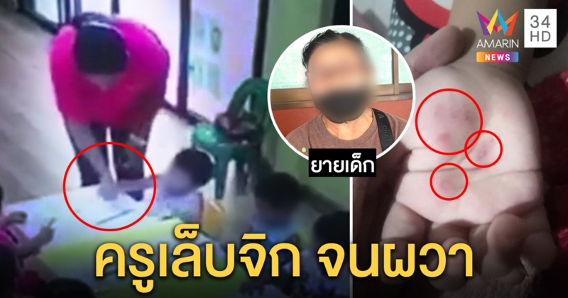 ไล่ออก! ครูพี่เลี้ยงเล็บจิกมือเด็กอนุบาล 3 ขวบ ยายลั่นไม่ยอมทำหลานผวา (คลิป)