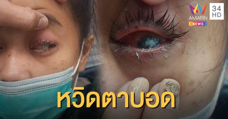 อุทาหรณ์ สาวใช้มือไม่สะอาด-เล็บยาวถอด "คอนแทคเลนส์" ตาติดเชื้อหวิดบอด