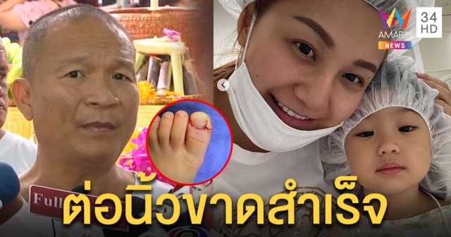 “หม่ำ” ช็อกกระจกโต๊ะร่วงทับแม่โป้งเท้าหลานขาด ทึ่งลูกสาวสติดีห่อน้ำแข็งให้หมอต่อ (คลิป)