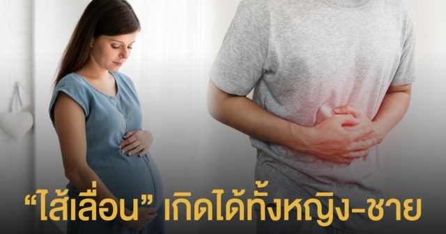 รู้ไหม...ไส้เลื่อนเกิดขึ้นได้ทั้งผู้หญิงและผู้ชาย