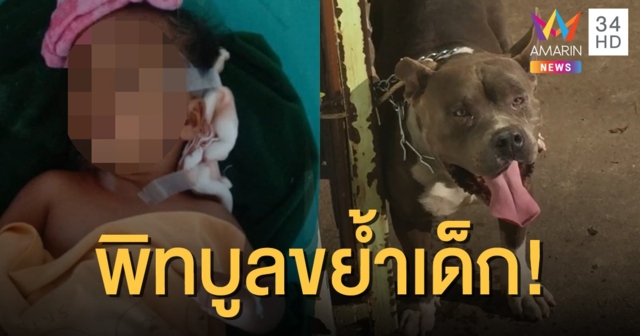 พิทบูลหวงเจ้าของ กระโจนขย้ำเด็ก 2 ขวบจมเขี้ยว!
