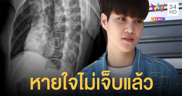 “หมอเจี๊ยบ” เล็งกลับไปต่อยมวยอีก อัพเดตอาการซี่โครงหักหายใจไม่เจ็บแล้ว