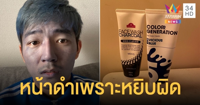 หนุ่มเอาครีมย้อมผมมาล้างหน้า ทำหน้าดำคล้ำ คนแตกตื่นนึกว่าป่วย