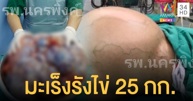 ชื่นชม! แพทย์เชียงใหม่ ผ่าตัด 