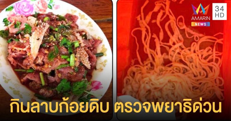 ศูนย์วิจัยโรคปรสิต เตือนกิน ลาบก้อยดิบ อย่าลืมตรวจพยาธิ