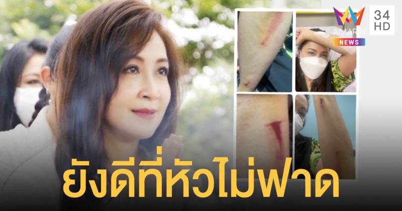 ยังดีที่หัวไม่ฟาด   กวาง กมลชนก   ขอฝากไว้เป็นอุทาหรณ์  เดินคุยโทรศัพท์พลาดลื่นตกบันได