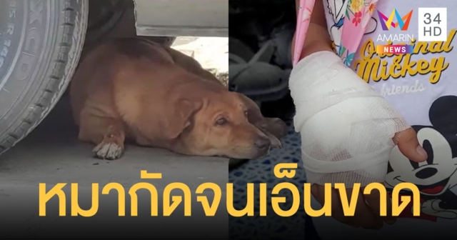 เด็กชายวัย 7 ขวบ ถูกสุนัขจรจัดบุกเข้าไปกัดข้อมือจนเอ็นนิ้วขาดถึงในบ้าน