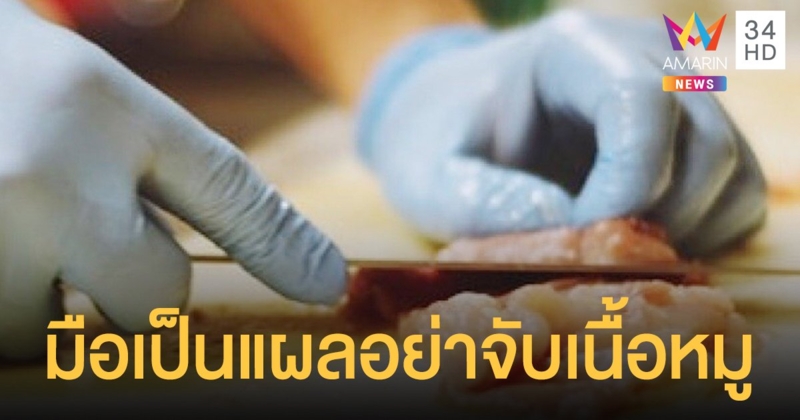 ระวัง โรคไข้หูดับ แนะ มือเป็นแผลอย่าจับเนื้อสัตว์ - เลิกกินดิบ