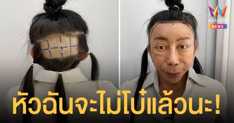จึ้งต่อไม่รอแล้วนะ แม่สิตางศุ์ บัวทอง ขึ้นเขียงปลูกผมเพิ่มความละมุน!