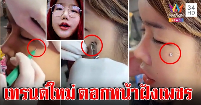 เทรนด์แปลกฝังจิวโหนกแก้ม สาวเปิดใจถอดไม่ได้ มั่นใจทำริมถนนไร้เสี่ยง แต่หมอโต้ (คลิป)