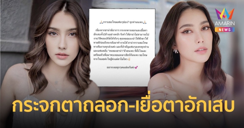 “ฮาน่า ลีวิส” ป่วยกระจกตาถลอก-เยื่อตาอักเสบทั้ง 2 ข้างอย่างหนัก