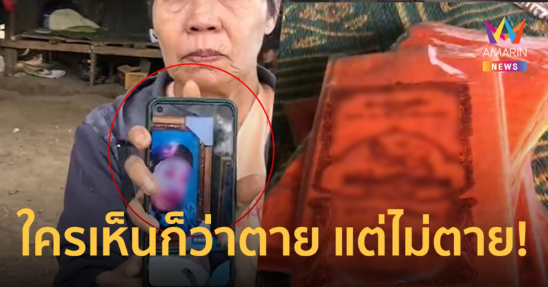 เตรียมงานศพเก้อ! หลานป่วยอาการโคม่า ญาติทำใจให้ถอดเครื่องออกซิเจน สุดท้ายไม่ตาย