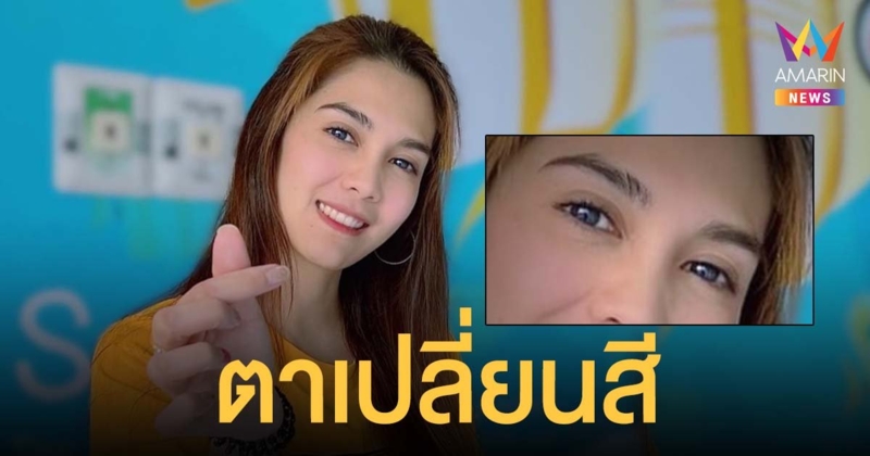 พั้นช์ วรกาญจน์ เผยตาเปลี่ยนสี จากการกินยาต้านไวรัส โควิดหายแล้ว-กักตัวต่อ