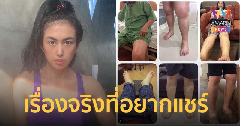 ตุ๊กตา อุบลวรรณ แชร์ประสบการณ์สามี เป็นโรคโปรตีนรั่วในปัสสาวะ