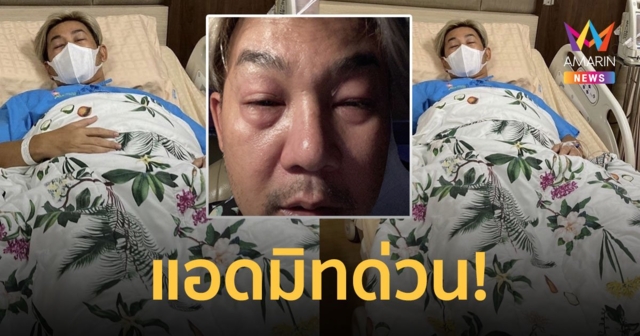 แอดมิทด่วน!  เอ๊าะ กีรติ  เกิดอาการแพ้รุนแรง! ต้องหายใจทางปาก โชคดีที่ถึงมือหมอทัน