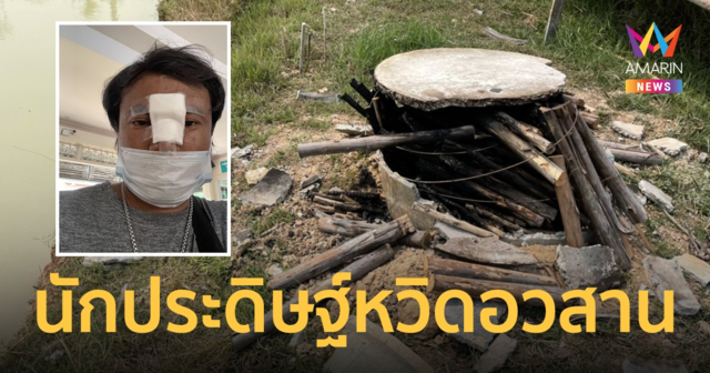 หวิดตาย! หนุ่มสุรินทร์ สร้างเตาเผาถ่านด้วยท่อวงส้วม เกิดระเบิดได้รับบาดเจ็บ