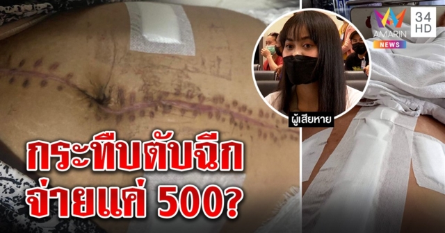 ผัวเก่าหึงโหดกระทืบสาวตับแตกม้ามฉีก เหยื่อผวาขู่ทำร้ายซ้ำ แฉจ่าย 500 จบคดี (คลิป)
