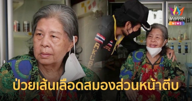 เผยชีวิต  ป้าเขียด นภาพร  นักแสดงอาวุโส ป่วยเส้นเลือดสมองส่วนหน้าตีบ ไม่สามารถพูดได้