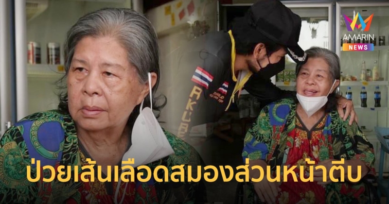 เผยชีวิต  ป้าเขียด นภาพร  นักแสดงอาวุโส ป่วยเส้นเลือดสมองส่วนหน้าตีบ ไม่สามารถพูดได้