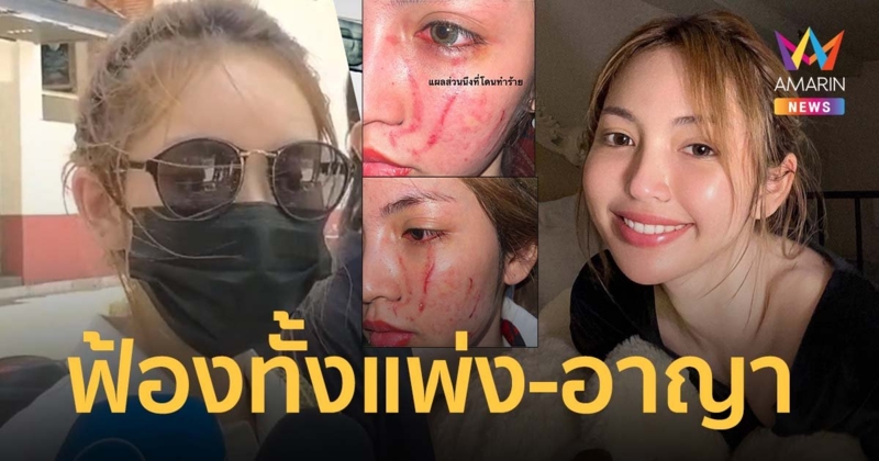 โนอา ภญมณ แจ้งความยันฟ้องทั้งแพ่งและอาญา โดนทำร้ายร่างกาย เสียงาน-​​สูญรายได้หลักล้าน