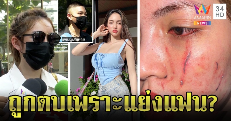โนอา พาพยานเอาผิด 2 มือตบหวิดทำเสียโฉม เผยปมตบสางแค้นเก่าแฟนหนุ่ม (คลิป)