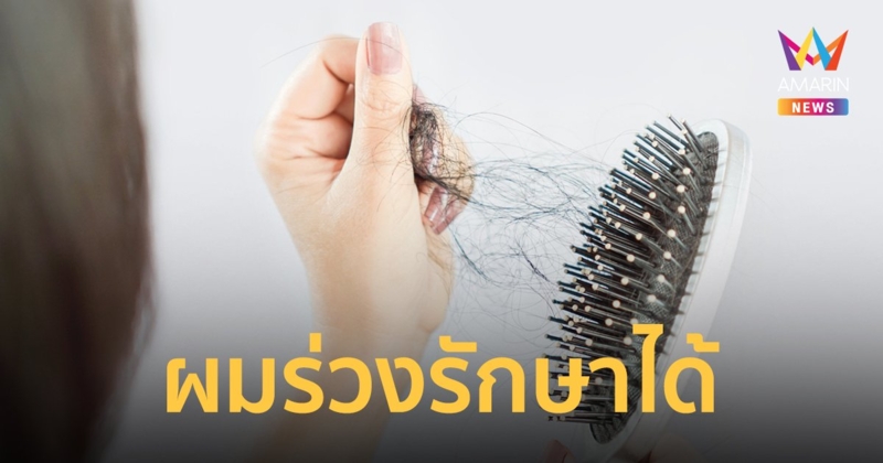 รู้ลึก 7 สาเหตุของภาวะผมร่วง สามารถรักษาได้พร้อมวิธีปฏิบัติหากมีอาการ