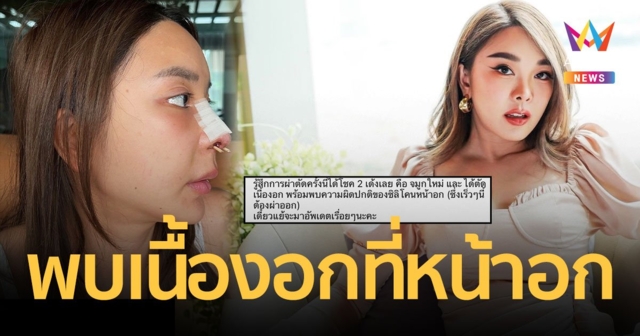 “หญิงแย้ นนทพร” เผยผ่าตัดจมูกเพื่อทำการรักษาและพบเนื้องอกที่หน้าอก 4 ซม.