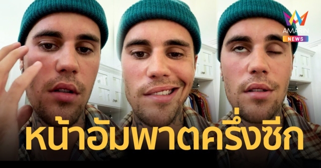 “จัสติน บีเบอร์” ป่วยใบหน้าอัมพาตครึ่งซีก ประกาศเลื่อนคอนเสิร์ตเวิลด์ทัวร์