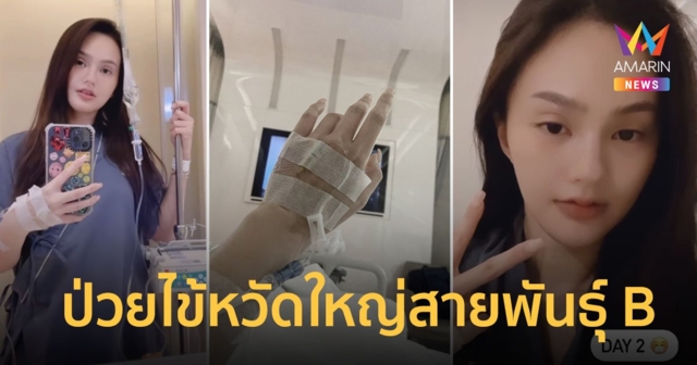 “นาย ชนุชตรา” แอดมิต รพ. ป่วยไข้หวัดใหญ่สายพันธุ์ B มีอาการเจ็บคอ-ไอ-มีน้ำมูก