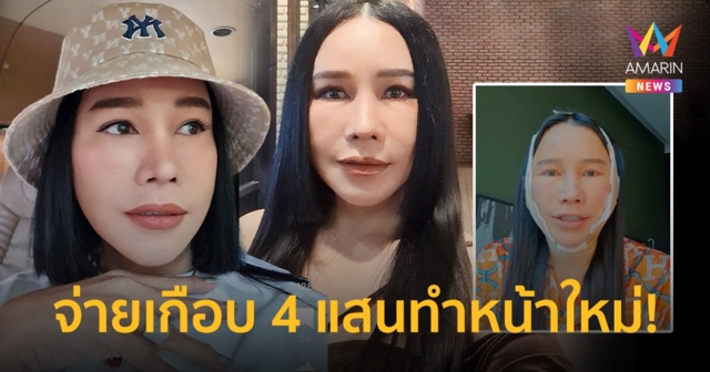“ส้มเช้ง สามช่า” เปิดหน้าใหม่สวยเป๊ะ! หลังทุ่มเงินศัลยกรรมเกือบ 4 แสน!