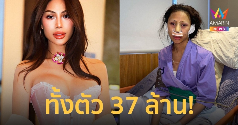 สวยฉ่ำมาก "ฟลุ๊ค กะล่อน" เผยโฉมใหม่ ทำศัลยกรรมทั้งตัว 37 ล้าน!