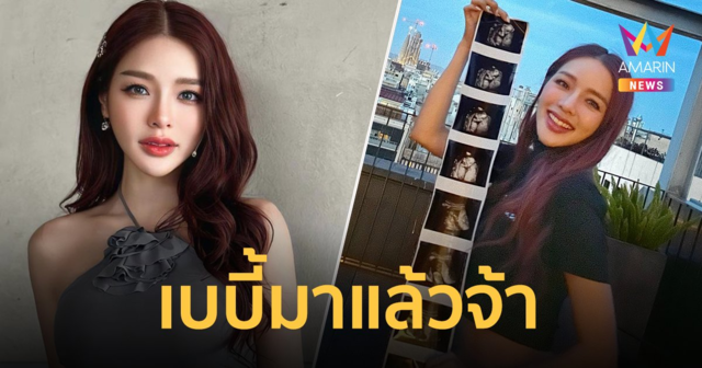 "แอร์ ภัณฑิลา" ท้องลูกคนแรก เผยได้ยินเสียงหัวใจลูก น้ำตาก็ไหล