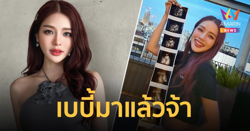 "แอร์ ภัณฑิลา" ท้องลูกคนแรก เผยได้ยินเสียงหัวใจลูก น้ำตาก็ไหล