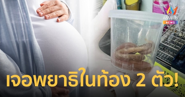 สาวท้องแก่ ปวดท้องไปหาหมอตรวจเจอ พยาธิไส้เดือน 2 ตัว คาด มาจากผักสด