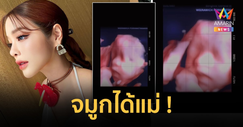 "แอร์ ภัณฑิลา" เผยโฉมลูกในครรภ์ จมูกโด่งพุ่ง ได้แม่มาเต็มๆ