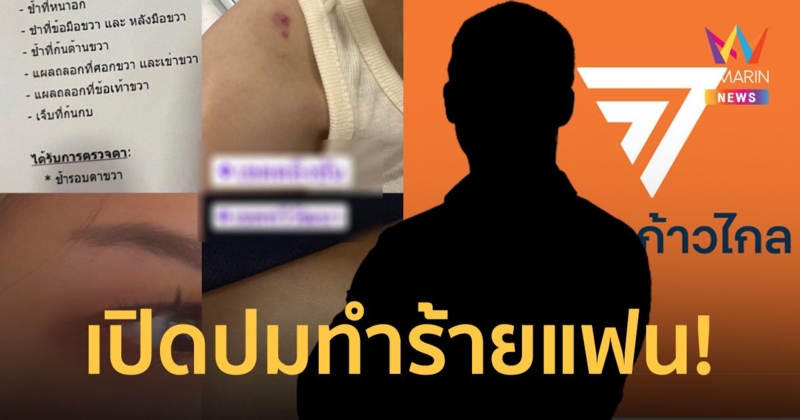 ส.ส.ก้าวไกล รับ ทำร้ายแฟนสาวจริง พร้อมเข้าไกล่เกลี่ยฝ่ายหญิง 30 มิ.ย.