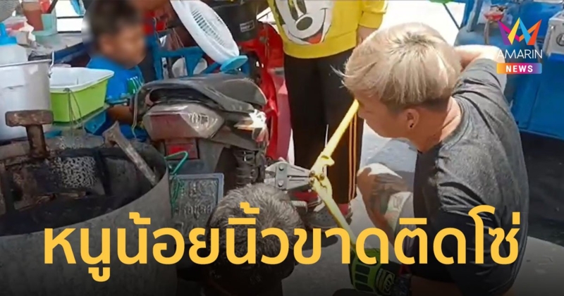 หวาดเสียว ! หนูน้อยวัย 5 ขวบ เท้าขัดโซ่รถจยย. นิ้วขาด