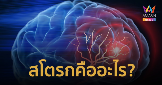 สโตรก (stroke) คืออะไร มีอาการ สาเหตุ และวิธีการป้องกันอย่างไร?