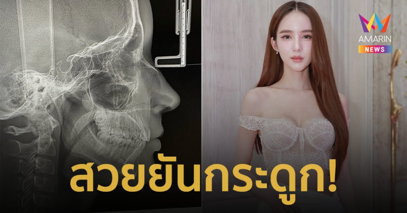 ลูกรักพระเจ้า! "โยชิ รินรดา" โชว์ฟิล์มเอกซเรย์สวยยันกระดูก