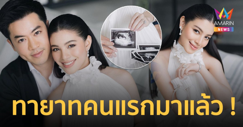 "แคท ซอนญ่า สิงหะ" ประกาศข่าวดี ตั้งท้องทายาทคนแรก