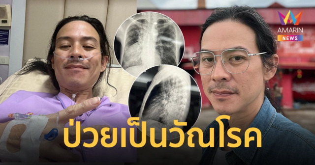 "จั๊ก ชวิน จิตรสมบูรณ์" เผยป่วยเป็นวัณโรค ได้รับเชื้อจากเพื่อนที่เพิ่งเสียชีวิต